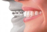 plano-odontologico-itapevi-1374773715